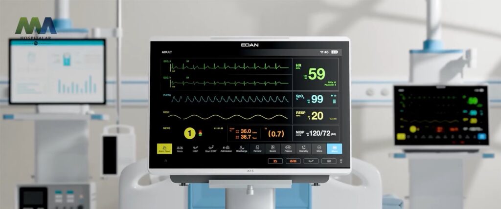 monitor hemodinamico ix edan Monitoramento inteligente na UTI
