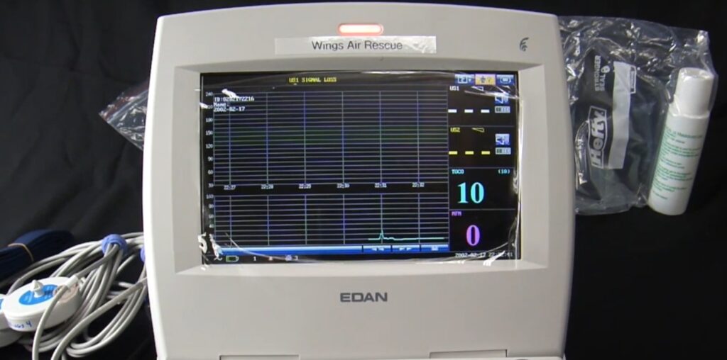 monitor fetal f6 express