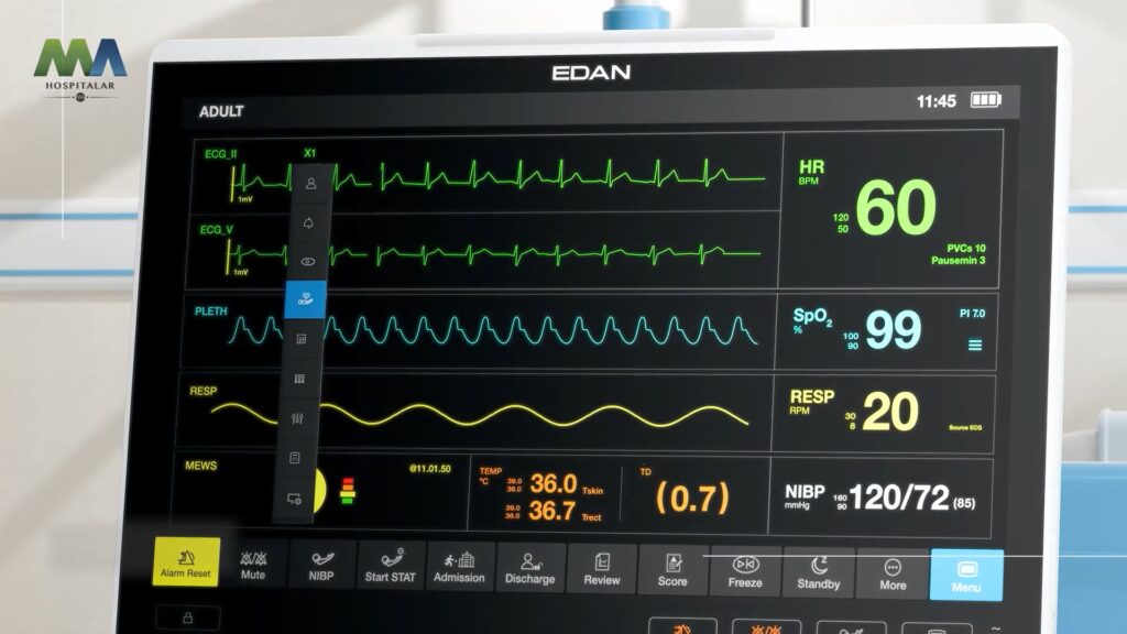 monitor hemodinâmico edan