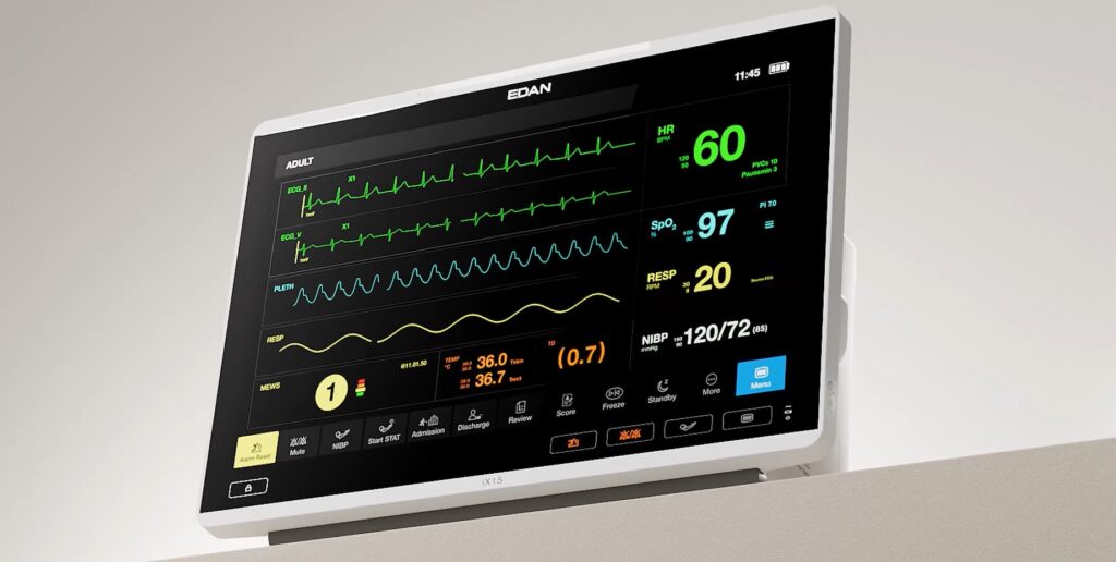monitor ix edan