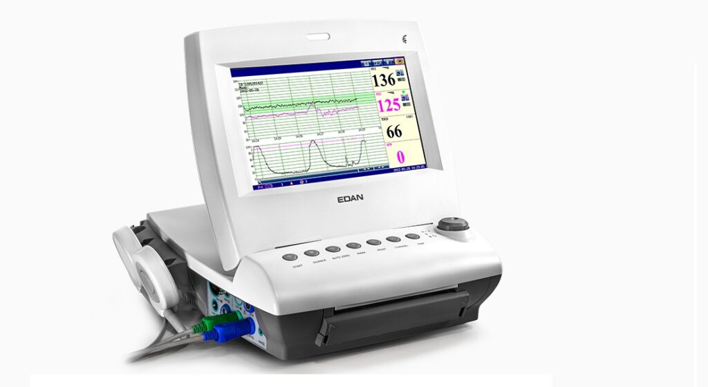Cardiotocografia (CTG)
