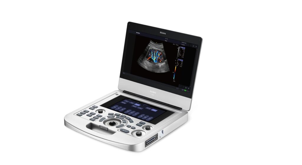 ultrassom acclarix ax 2