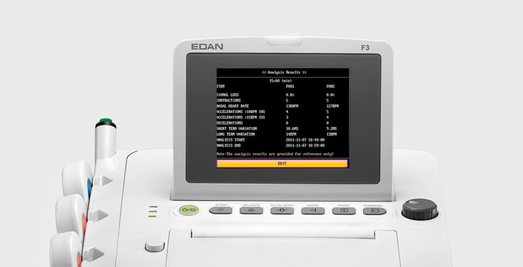 Imagem mostra um equipamento médico usado para monitoramento, na tela estão alguns dados.