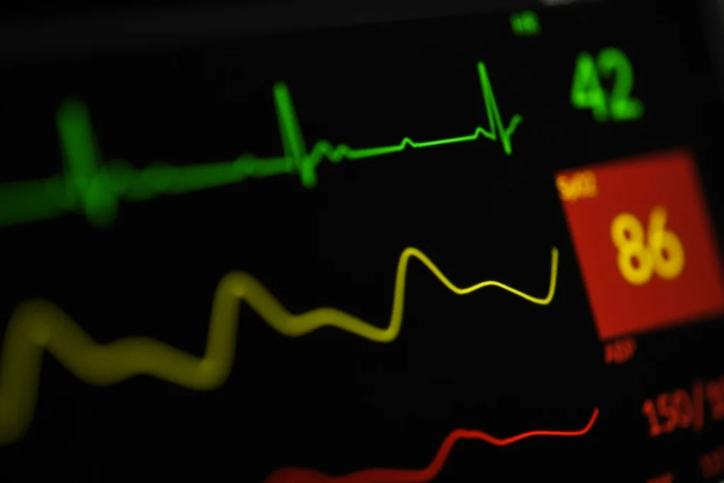 imagem de um ecg