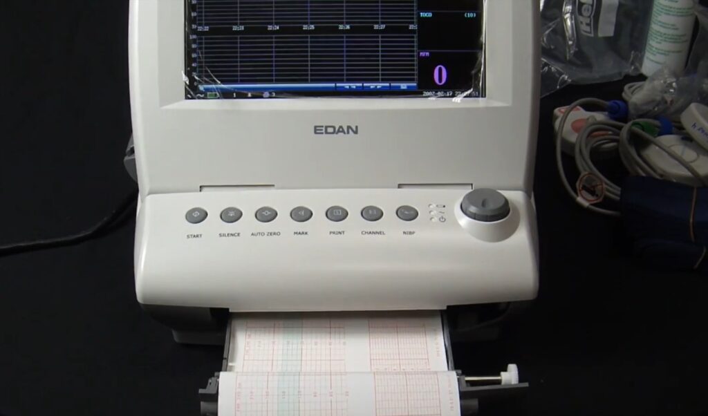 Imagem de um aparelho medico da marca EDAN, usado para monitoramento de sinais vitais.