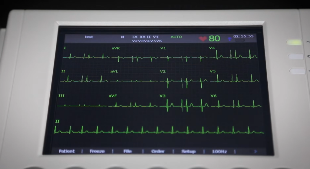eletrocardiógrafo edan SE1200