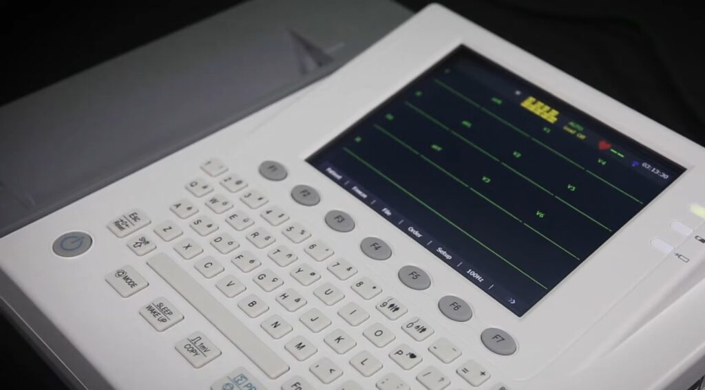 Imagem mostra um aparelho de eletrocardiograma