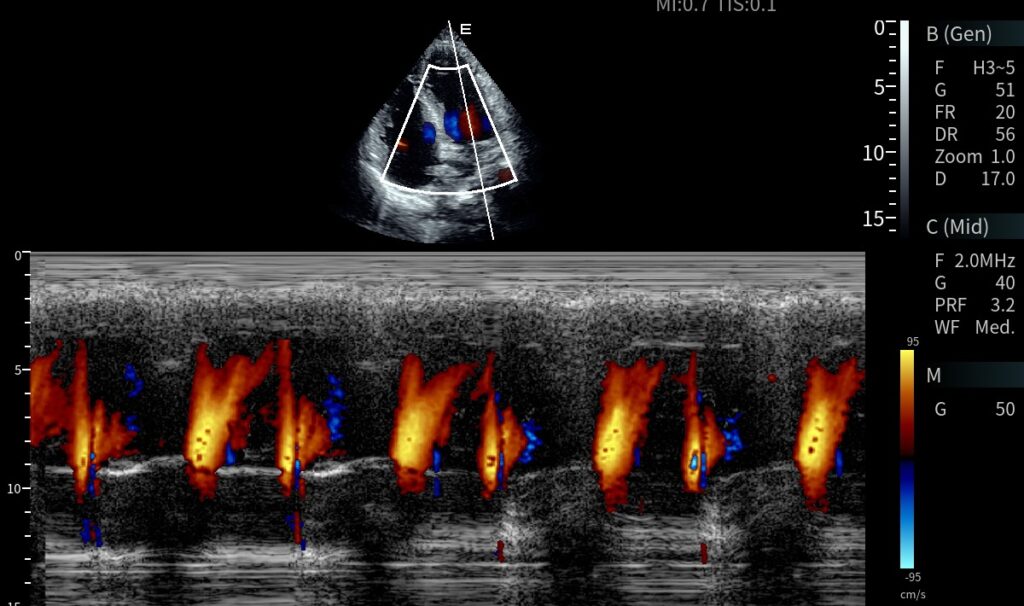 imagem do ultrassom ax8