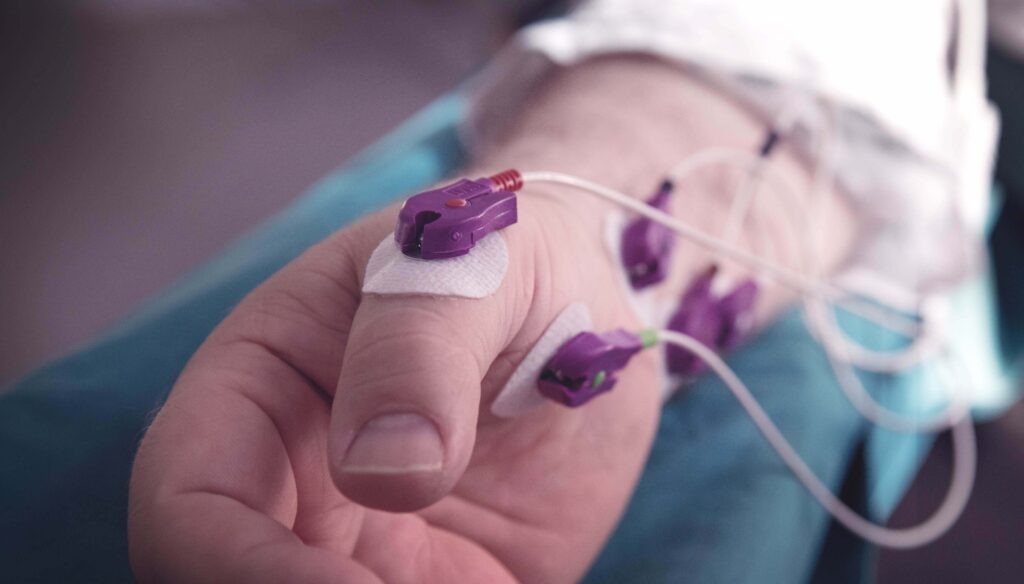 imagem de mão com eletrodos do tnm da ge healthcare