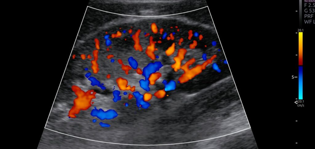 Quais especialidades médicas precisam de ultrassom?
