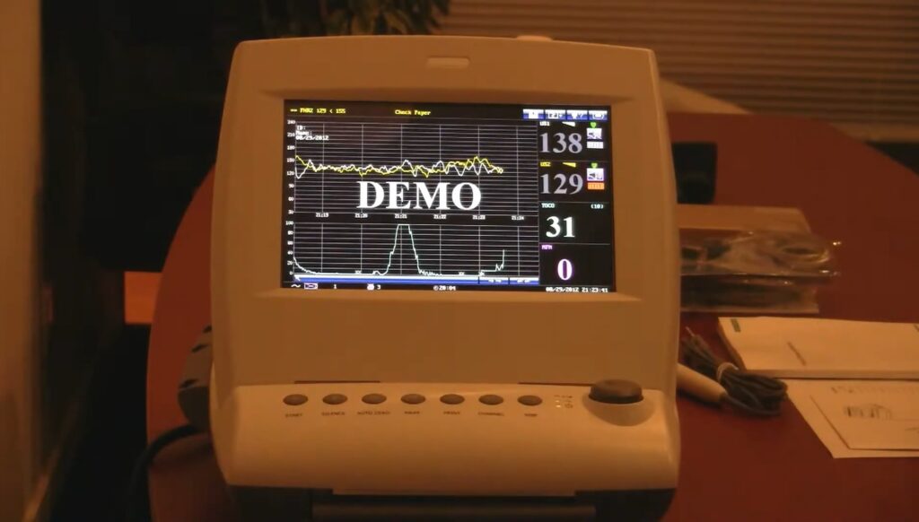 monitor fetal f6 edan sendo utilizado para demonstração